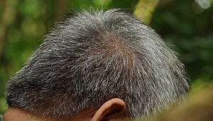 Saç dökülmesine karşı hangi şampuan tercih edilmeli?