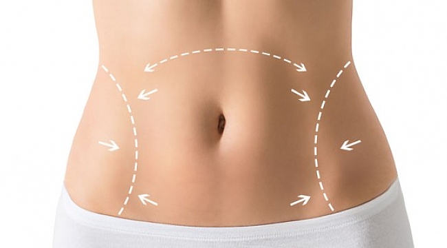 Karın Germe Ameliyatı ve Angel Lip Lifting Uygulamsı