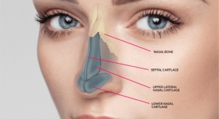 Burun estetiği yaptırdıktan sonra bunlara dikkat edin