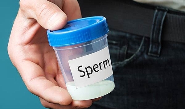 Sperm donasyonu nedir?