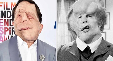 Fil Adam'ın uyarlamasında başrol belli oldu: Adam Pearson Joseph Merrick'i canlandıracak
