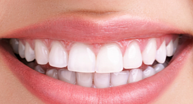 Diş Beyazlatma ile Işıldayan Bir Gülüşe Kavuşmanın Yolları